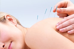 Contemporary Medical Acupuncture